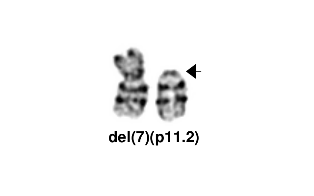 del(7)(p11.2)