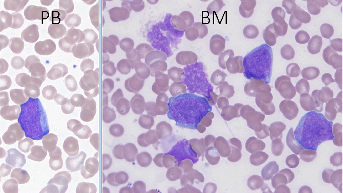 Thumbnail for version as of 09:58, 3 August 2018