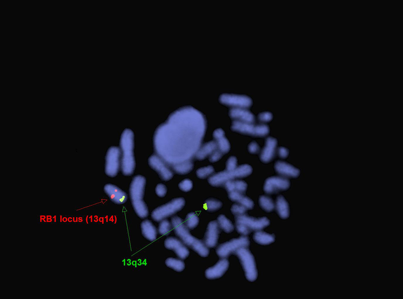 Thumbnail for version as of 20:32, 17 July 2018