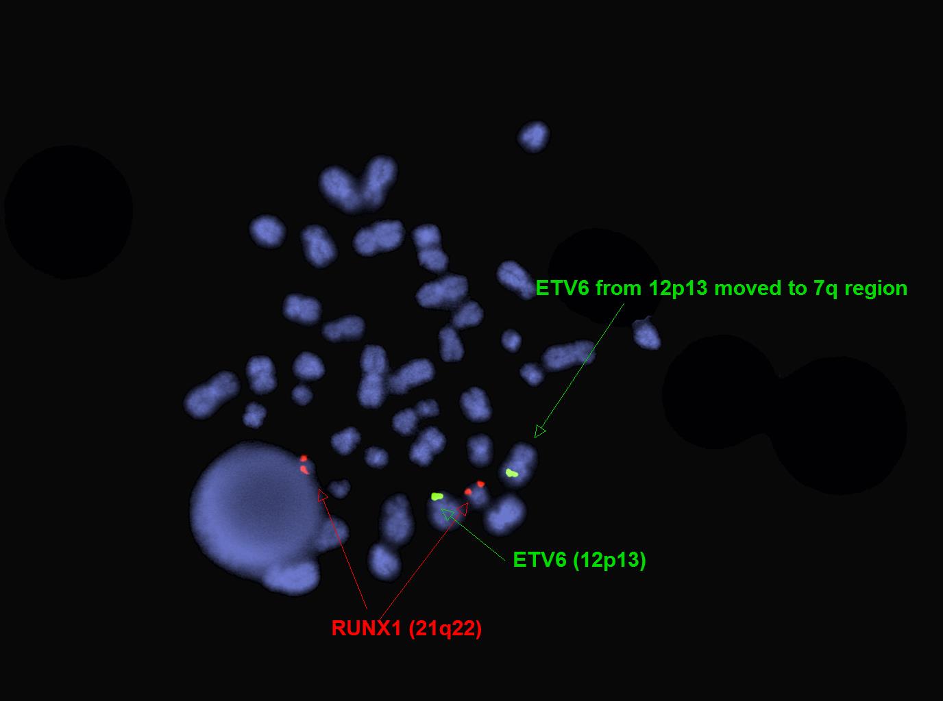 Thumbnail for version as of 20:23, 17 July 2018