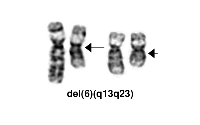 File:Del(6)(q13q23).png