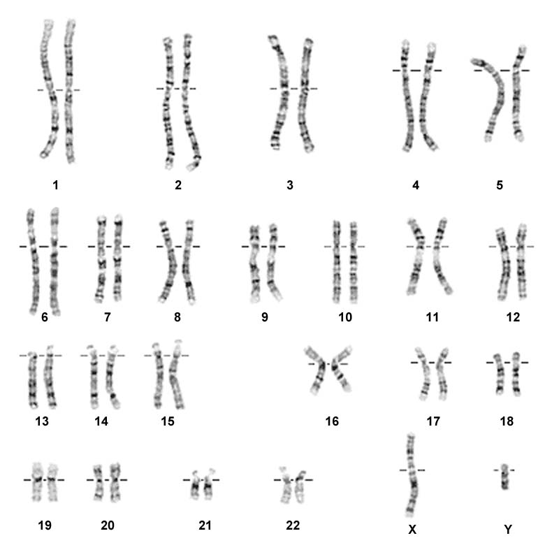 File:Normal karyotype.jpg